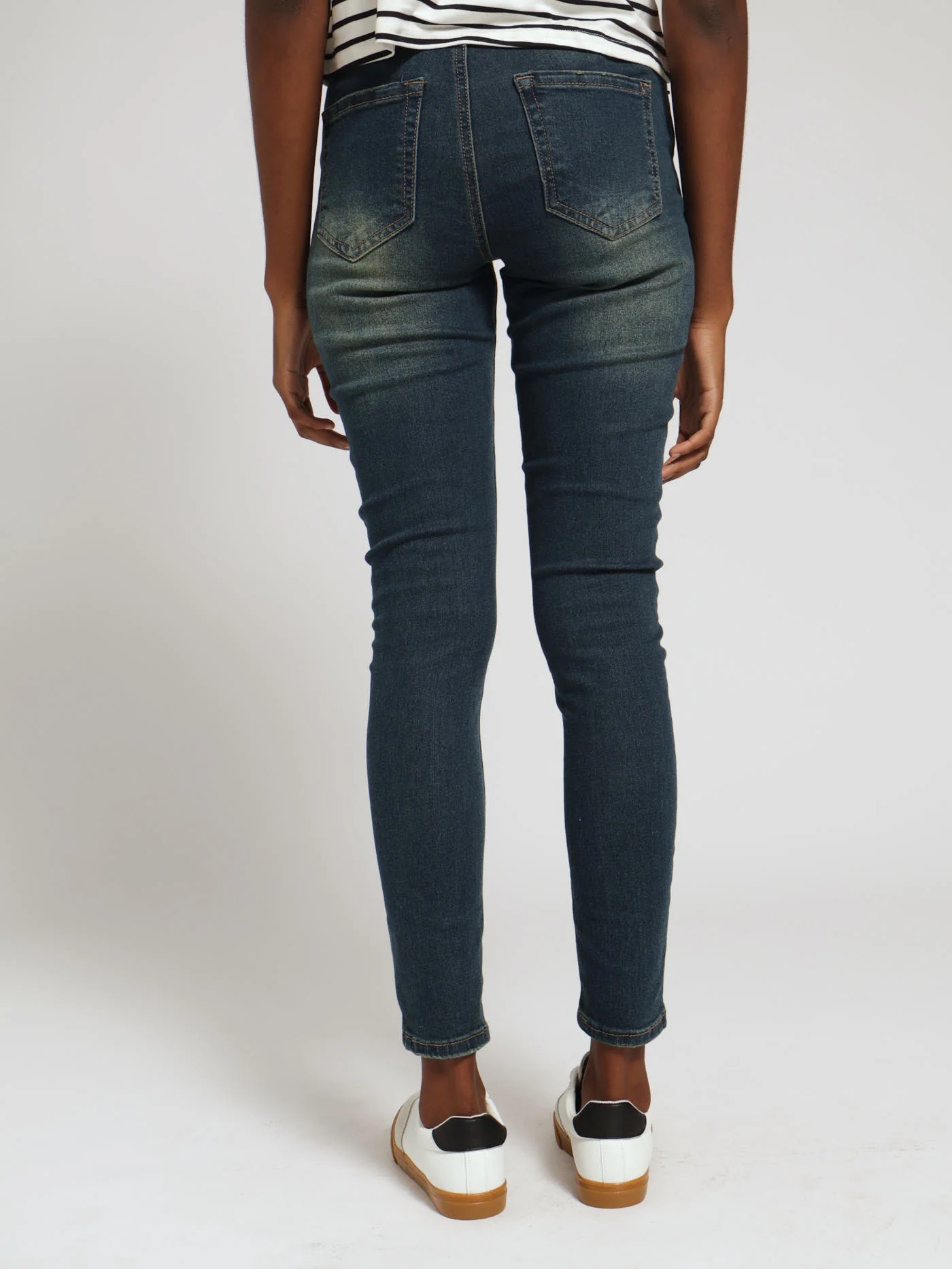 Tea Stained Abraised Skinny Jean - Dark Wash - Image 3